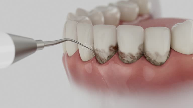 Reliable Dental contractor in Perry, OH by Dentist Open Now